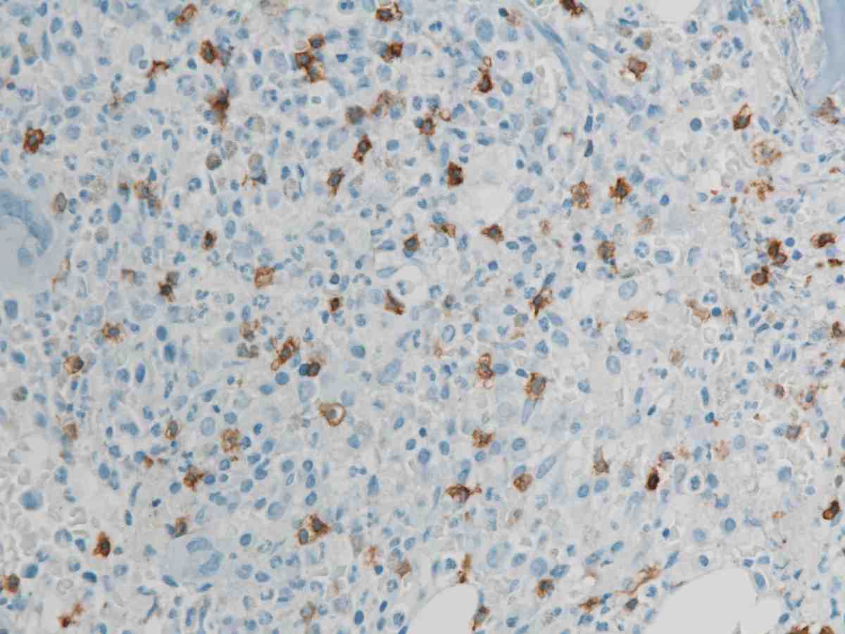 Bone Marrow CD3 40X